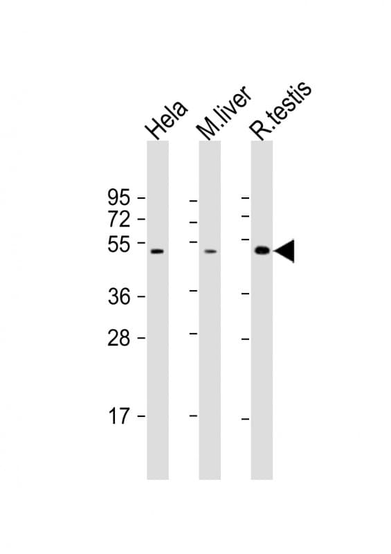 CHRNB2 Antibody (aa66-100)