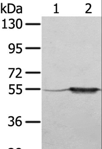 Polyclonal Rabbit anti-Human TRIM35 Antibody (IHC, WB)