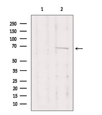 PRKCI / PKC Iota Antibody