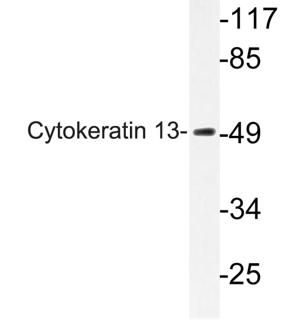 Polyclonal Rabbit anti-Human KRT13 / CK13 / Cytokeratin 13 Antibody (aa233-282, IHC, WB)