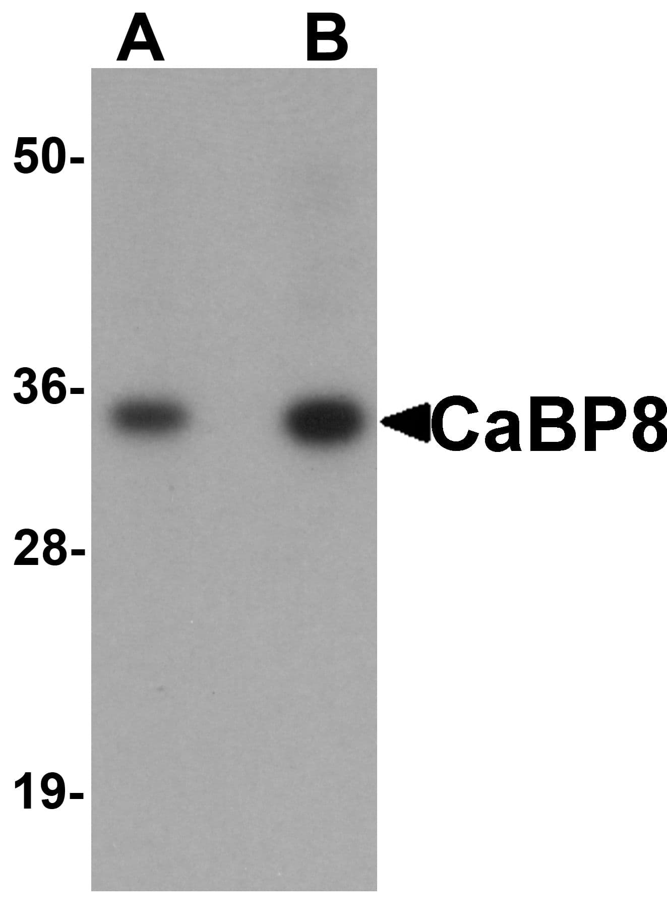 IHC-plus™ Calneuron-1 / CALN1 Antibody