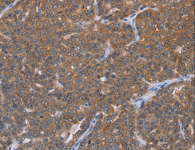Polyclonal Rabbit anti-Human I-BABP / FABP6 Antibody (IHC, WB)
