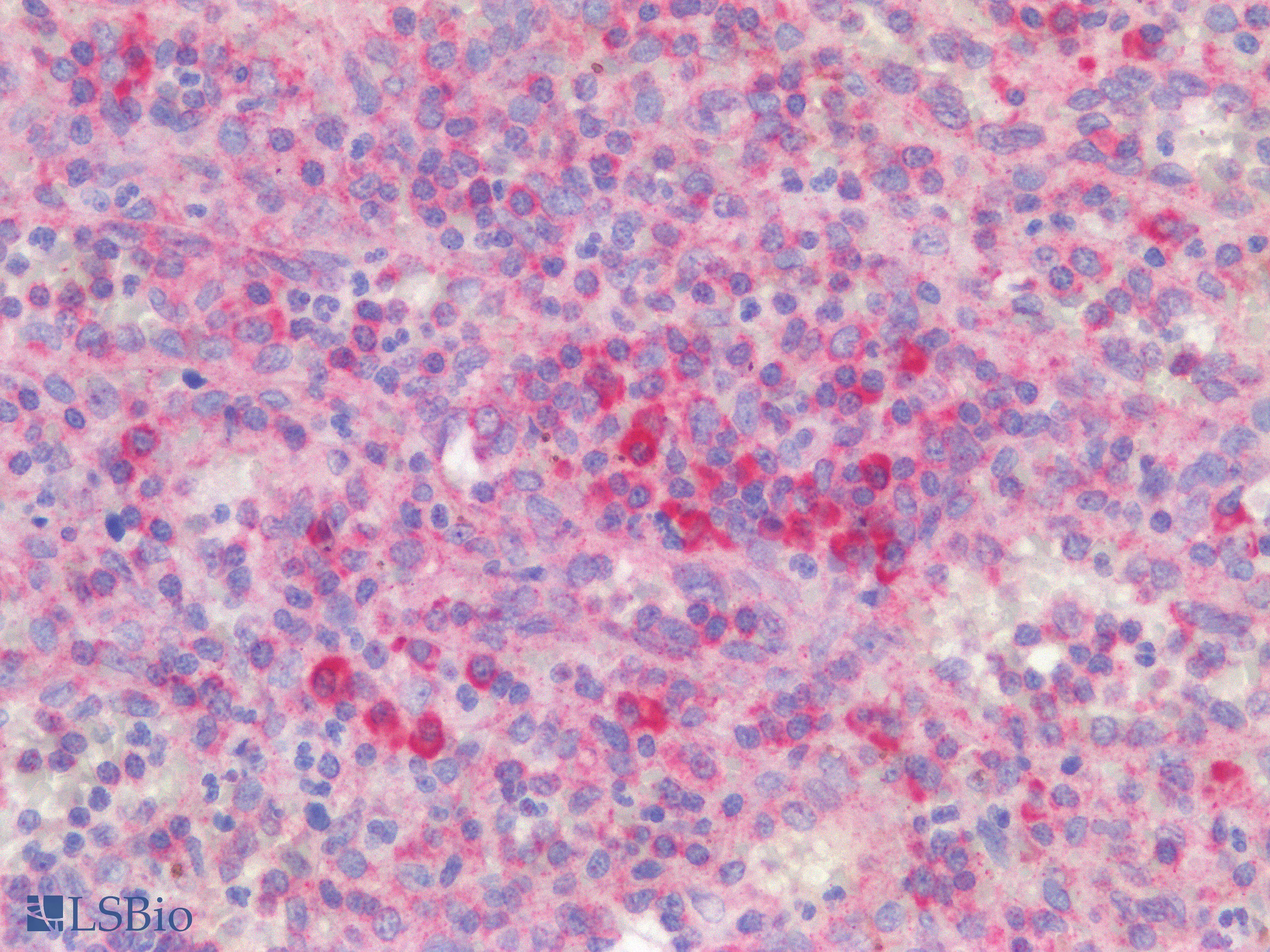 IHC-plus™ ICOS / CD278 Antibody
