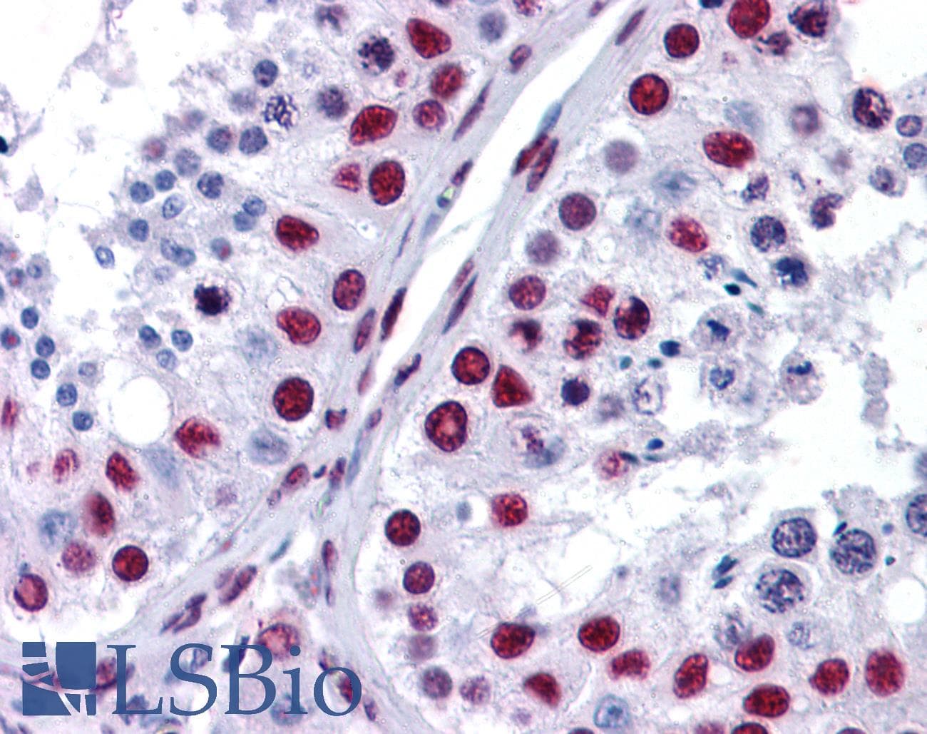 IHC-plus™ NONO / P54NRB Antibody (aa455-467)