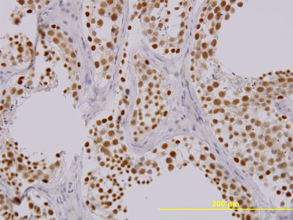 TAOK1 / TAO1 Antibody (clone 4E12)