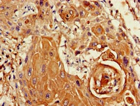 Polyclonal Rabbit anti-Human SETD5 Antibody