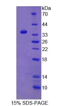 Rat TLR8 Protein (Recombinant His-T7)