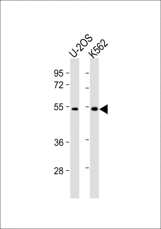 Polyclonal Rabbit anti-Human CHTF8 / C10orf18 Antibody (C-Terminus, WB)