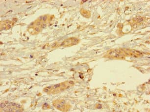 Polyclonal Rabbit anti-Human YIPF6 Antibody