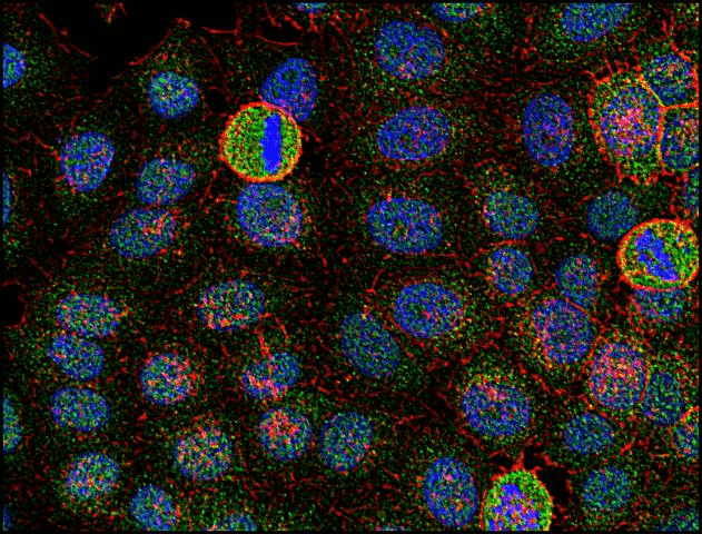 IHC-plus™ Monoclonal Mouse anti-Human SYN / FYN Antibody (clone FYN-01, aa7-176, IHC, WB)