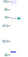 Human SNX6 Protein (Recombinant GST)