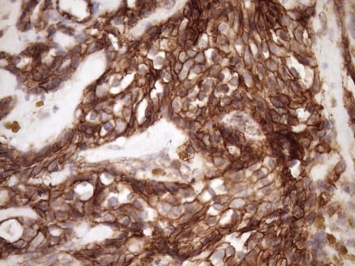 CTNNB1 / Beta Catenin Antibody (aa29-118, clone OTI2F10, Carrier-free)