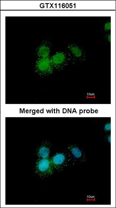 PR / Progesterone Receptor Antibody (aa18-112)