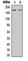 CML / BCR Antibody (phospho-Tyr360)