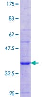 Human CHRNA1 Protein (Recombinant GST, N-terminus)