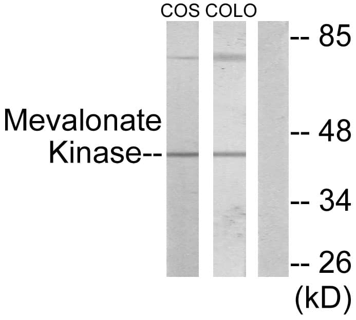 MVK Antibody (aa151-200)