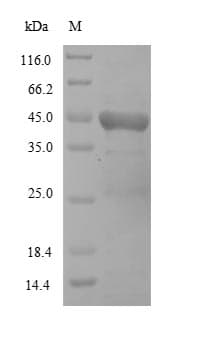Newcastle Disease Virus HN Protein (Recombinant 10His, N-terminus + Myc, C-terminus)