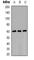 Polyclonal Rabbit anti-Human AKT2 Antibody (IHC, WB)