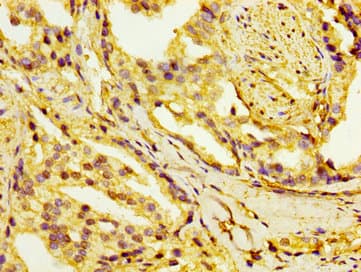 HSD17 / HSD17B1 Antibody