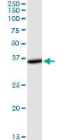 THUMPD1 Antibody (clone 4A11)