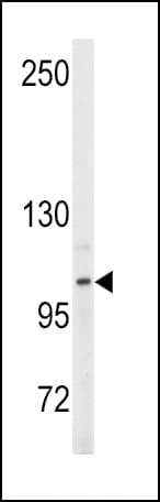 ENPP2 / Autotaxin Antibody (aa401-430)
