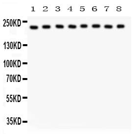ITGA5/Integrin Alpha 5/CD49e Antibody (aa787-992)