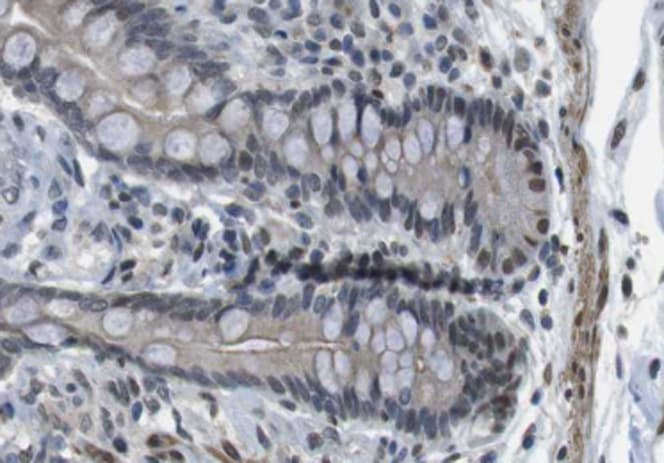 Polyclonal Rabbit anti-Human ANO9 / TMEM16J Antibody (IHC, IF, WB)