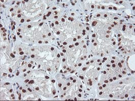 EXOSC7 Antibody (clone OTI1G8)
