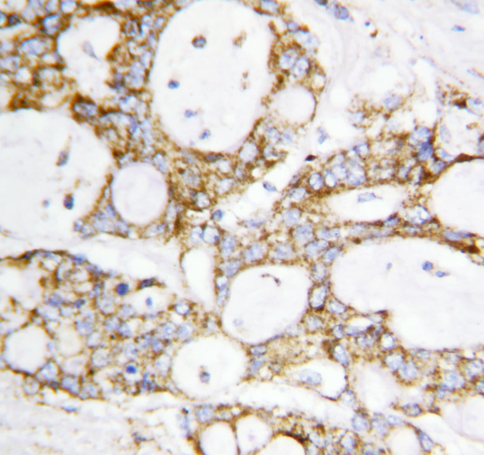 DLD / Diaphorase / E3 Antibody (aa492-509)