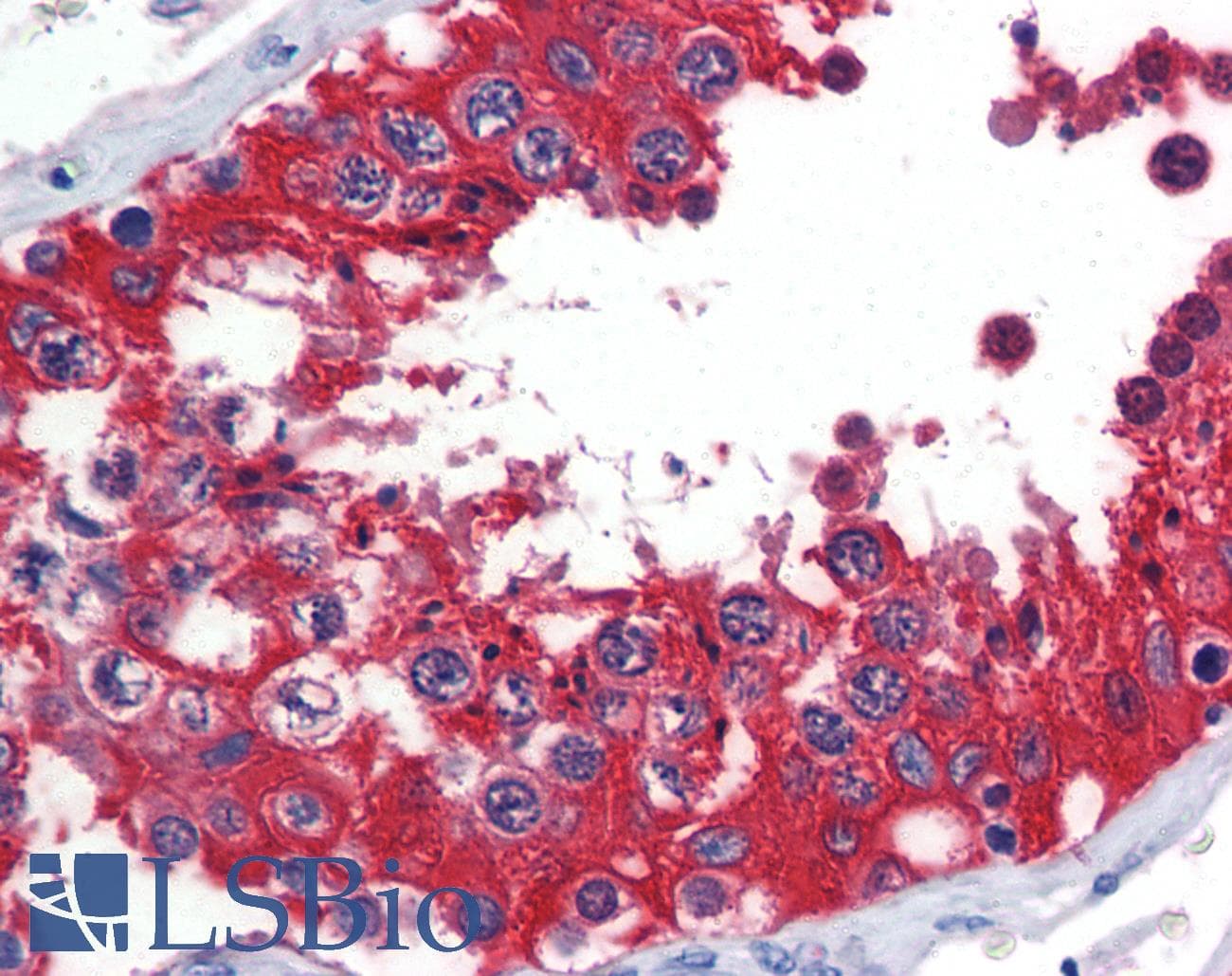 IHC-plus™ Monoclonal Mouse anti-Human G6PD Antibody (clone AT2F6, IHC, WB)
