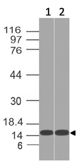 ACOT13 / THEM2 Antibody