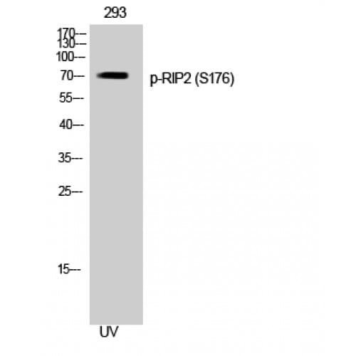 RICK / RIP2 Antibody (120-200 aa)