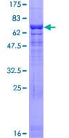 Human ACTR6 Protein (Recombinant GST)