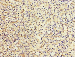 Polyclonal Rabbit anti-Human DEC-205 / CD205 / LY75 Antibody (IHC, WB)