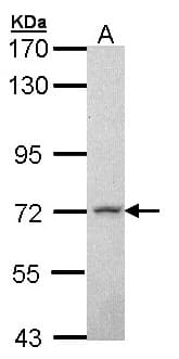 MPP2 Antibody (aa11-261)