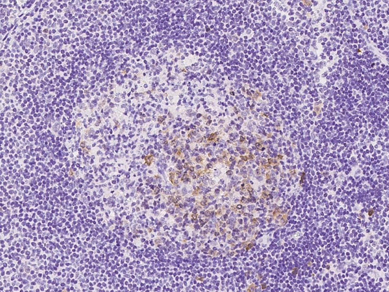 UBE2S / E2 EPF Antibody