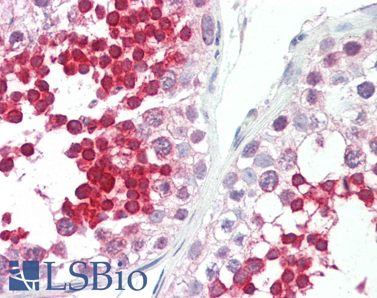 ROPN1L Antibody (C-Terminus)