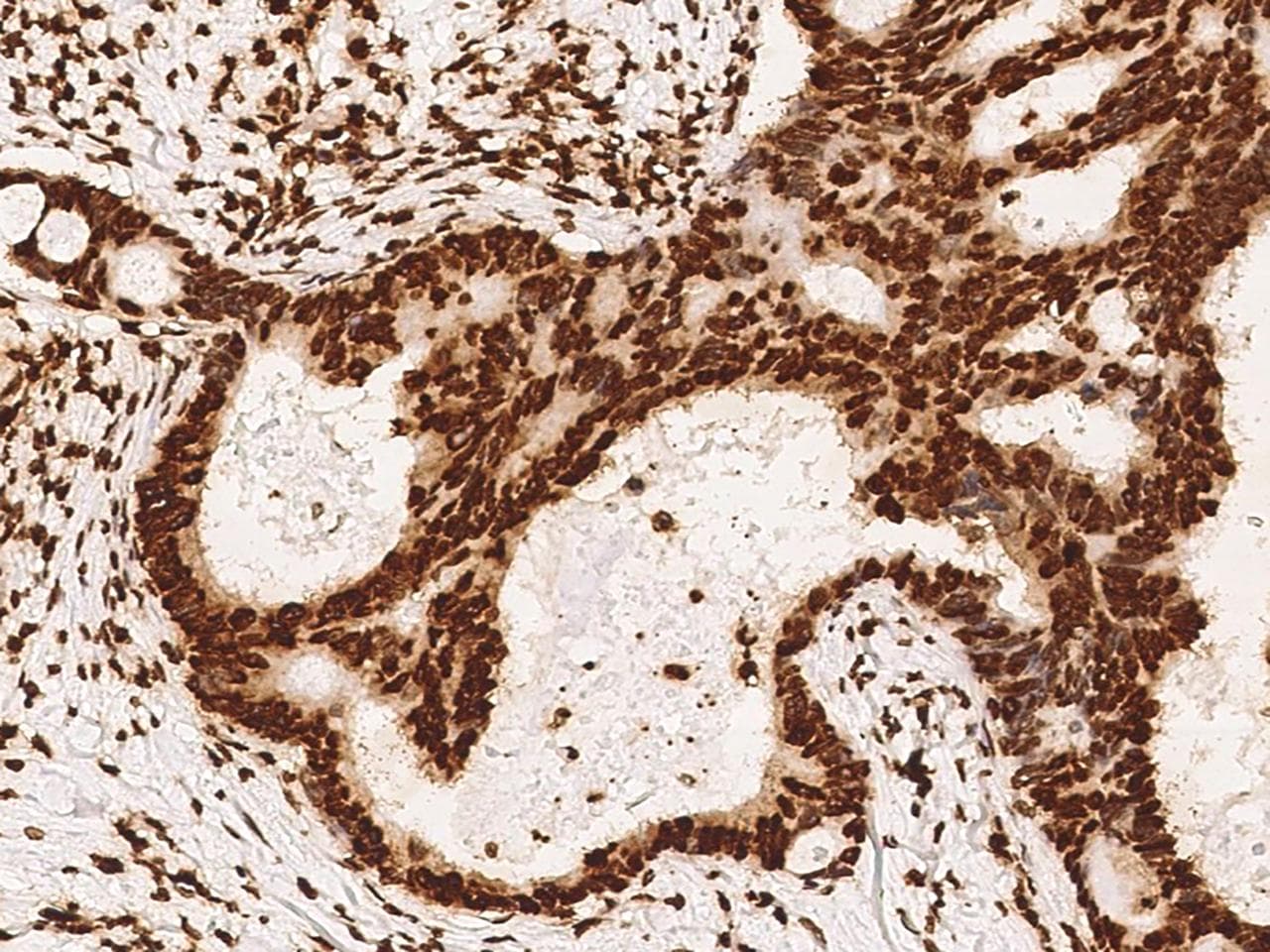 HIST1H3A Antibody (Preservative Free)