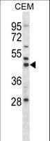 MAP2K2 / MKK2 / MEK2 Antibody (aa36-63)