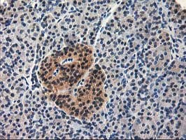 ALS2CR1 / NIF3L1 Antibody (clone OTI3E1)