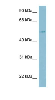 Polyclonal Rabbit anti-Human LBP Antibody (aa143-192, WB)