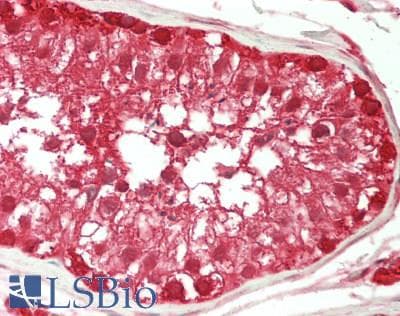 IHC-plus™ GSK3A / GSK3 Alpha Antibody