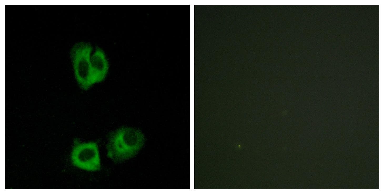 p56lck / LCK Antibody (phospho-Tyr393)