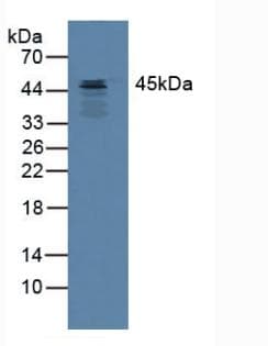 SERPINB3 Antibody (aa1-210)