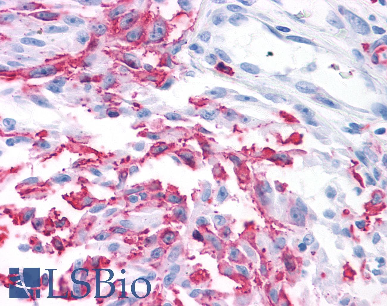 PathPlus™ GRM2 / MGLUR2 Antibody (N-Terminus)
