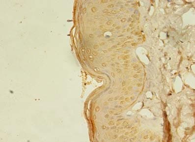 Polyclonal Rabbit anti-Human RTKN2 Antibody (IHC)