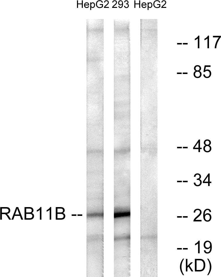 Polyclonal Rabbit anti-Human RAB11B Antibody (WB)