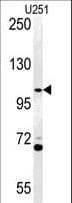 ACAP3 Antibody (aa101-130)