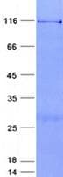Human HJURP Protein (Recombinant GST, N-terminus + His, C-terminus)