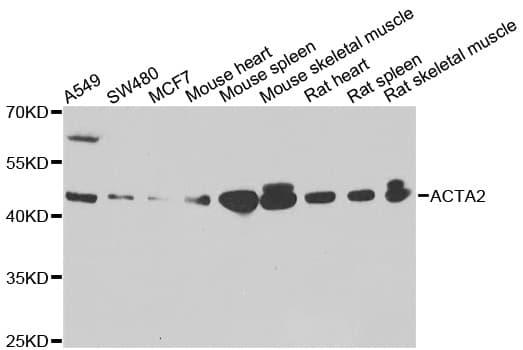 Polyclonal Rabbit anti-Human ACTA2 / Smooth Muscle Actin Antibody (IHC, WB)